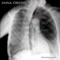 Skorna står kvar - Anna Öberg