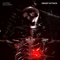 Heart Attack - Dlugosh