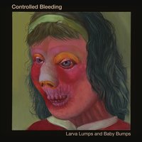 Eye of Needle - Controlled Bleeding