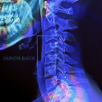 거북목 (HUNCHBACK) - REDDY