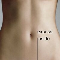 The Legs Show - eXcess