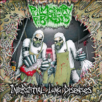 Interstitial Lung Diseases - Pulmonary Fibrosis