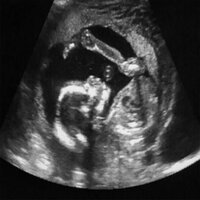 Womb Sound 8 - White Noise Babies & White Noise & Baby Sleep Sounds