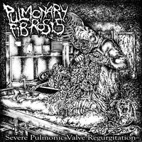 Corrosive Digestion of Embryonic Corpus - Pulmonary Fibrosis