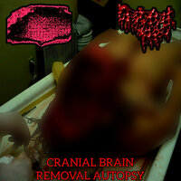 A Prostate Cancer Sandwich - Degenerates Boiled Alive In Raw Human Faeces