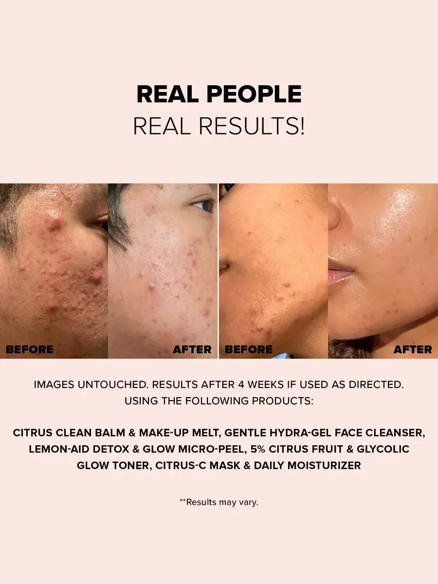 Увлажняющий крем-маска для лица Citrus-C Mask & Daily Moisturizer, 60 мл NUDESTIX — изображение 4 из 9
