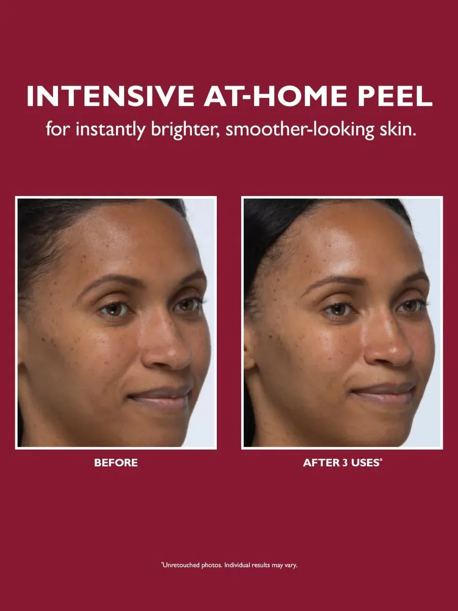 Пилинг Peter Thomas Roth — Для лица Even Smoother Instant Reveal — изображение 4 из 7