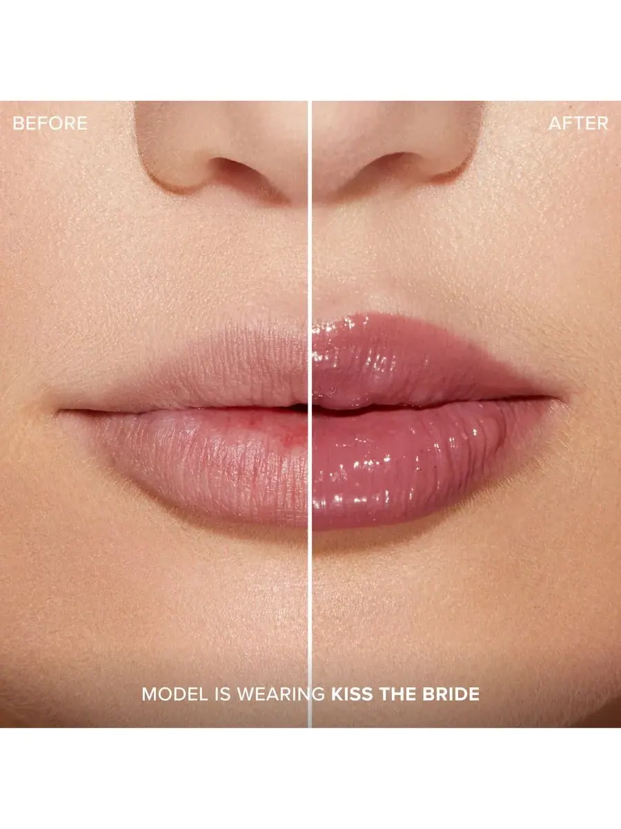 Увеличение губ с помощью инъекций для экстремального эффекта Clicks Too Faced, Kiss The Bride — изображение 3 из 9