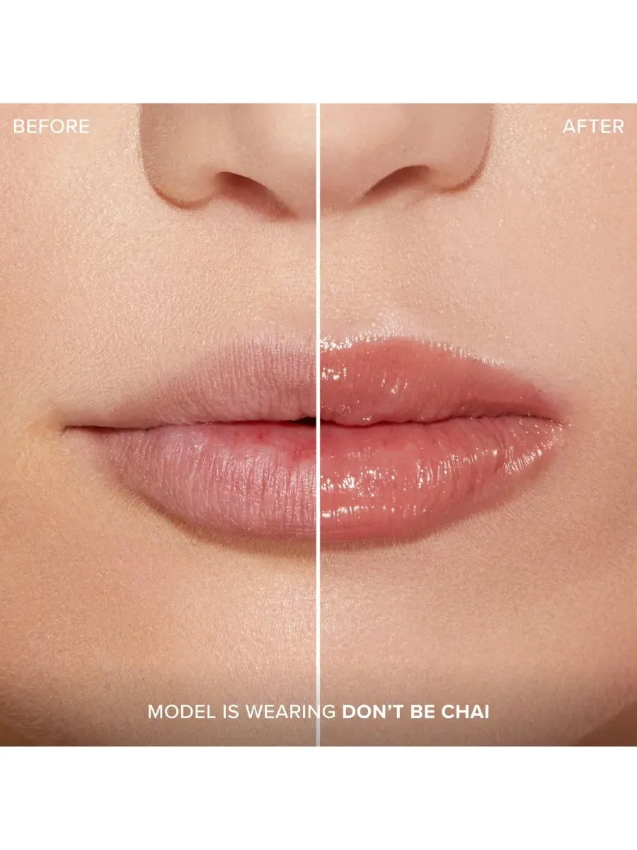 Увеличение губ с помощью инъекций для экстремального эффекта Clicks Too Faced, Dont Be Chai — изображение 3 из 10