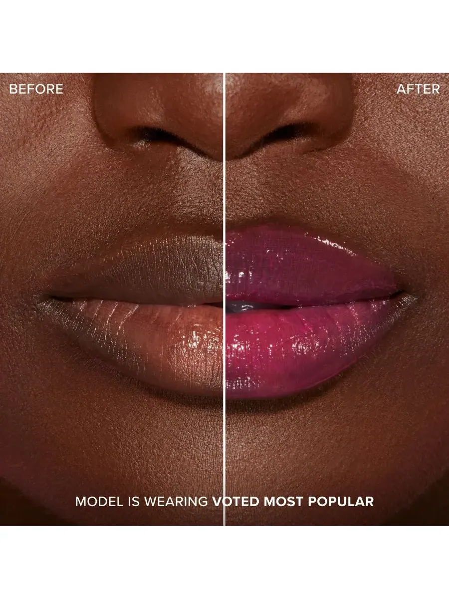 Увеличение губ с помощью инъекций для экстремального эффекта Clicks Too Faced, Voted Most Popular — изображение 2 из 9