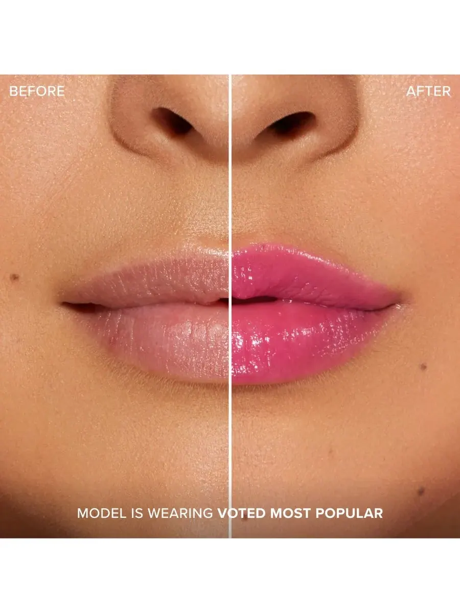 Увеличение губ с помощью инъекций для экстремального эффекта Clicks Too Faced, Voted Most Popular — изображение 7 из 9