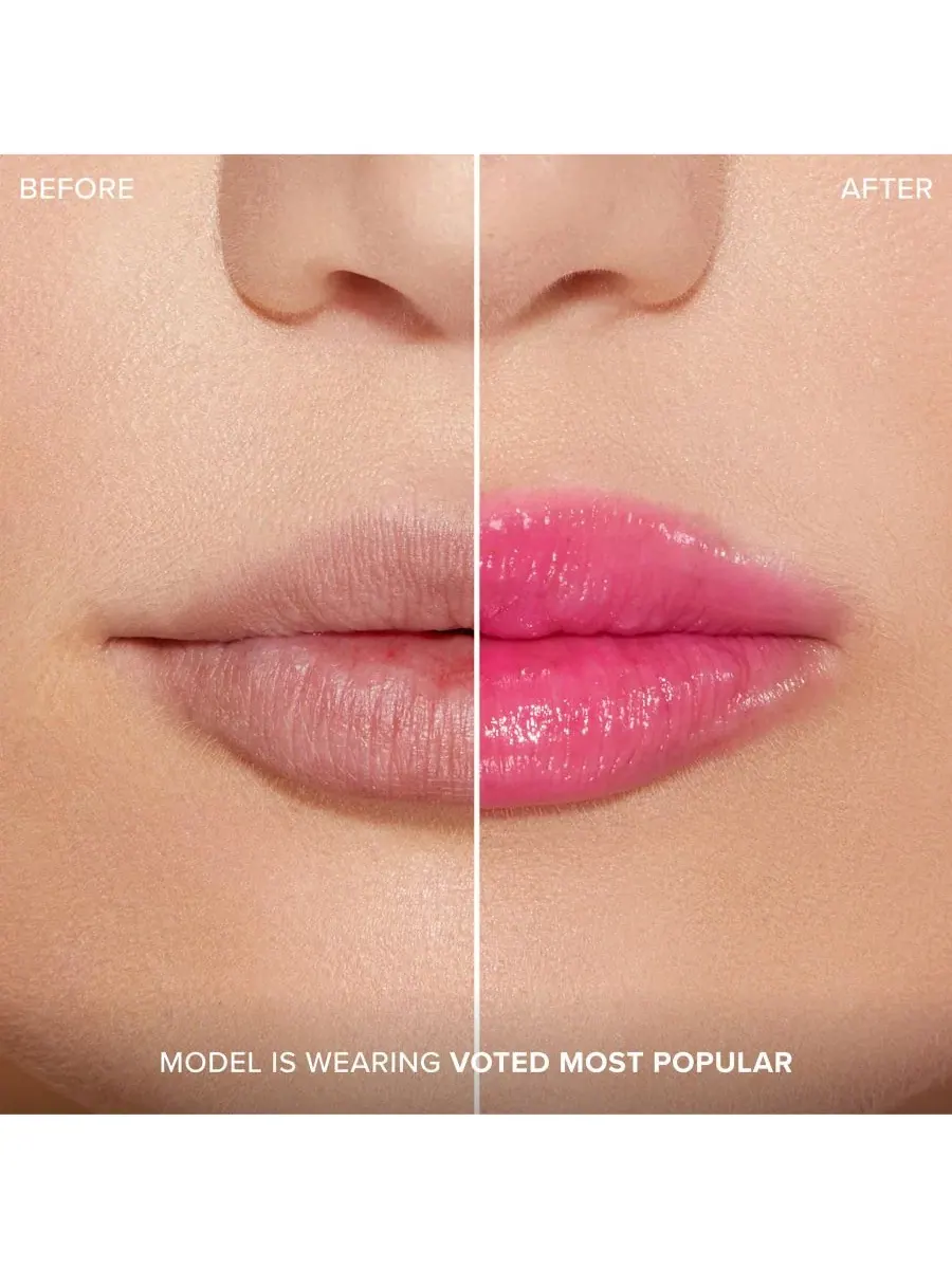 Увеличение губ с помощью инъекций для экстремального эффекта Clicks Too Faced, Voted Most Popular — изображение 8 из 9
