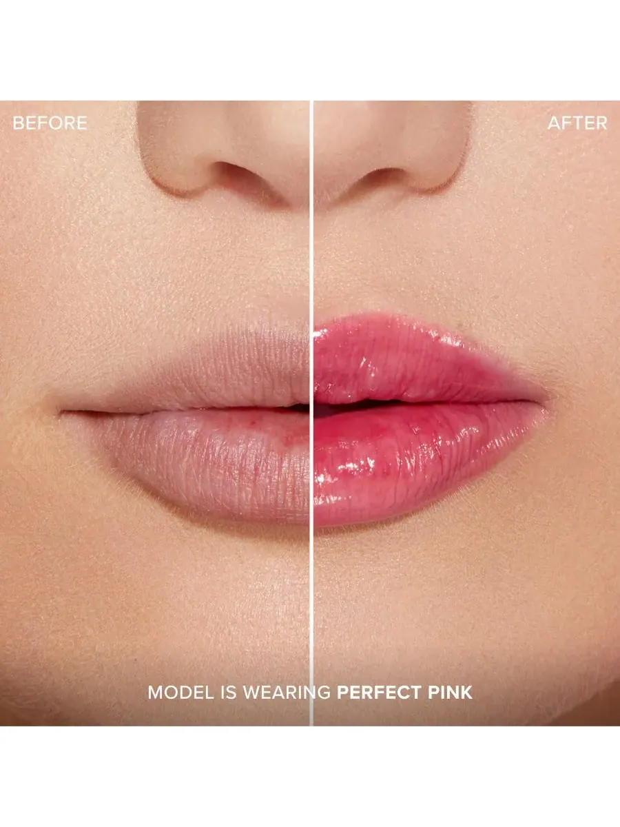 Увеличение губ с помощью инъекций для экстремального эффекта Clicks Too Faced — изображение 3 из 9