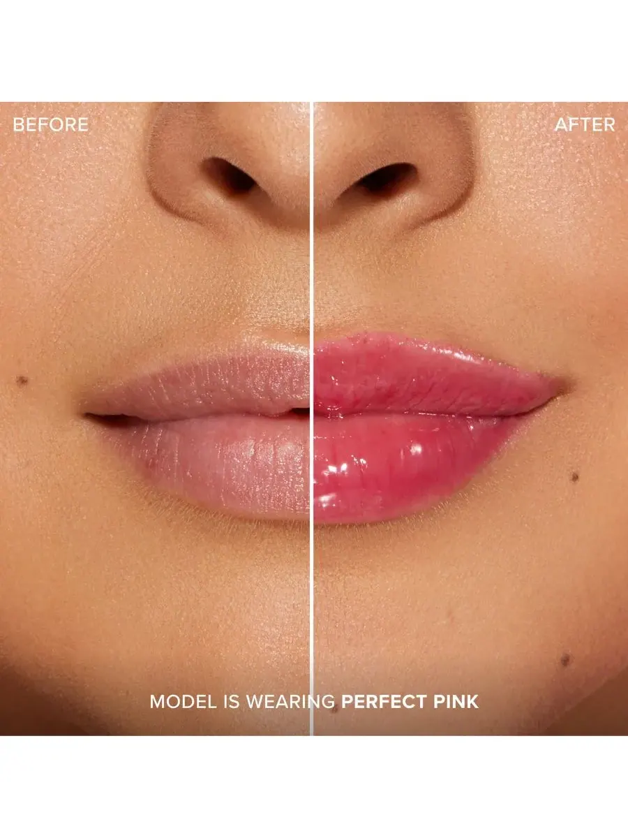 Увеличение губ с помощью инъекций для экстремального эффекта Clicks Too Faced — изображение 4 из 9