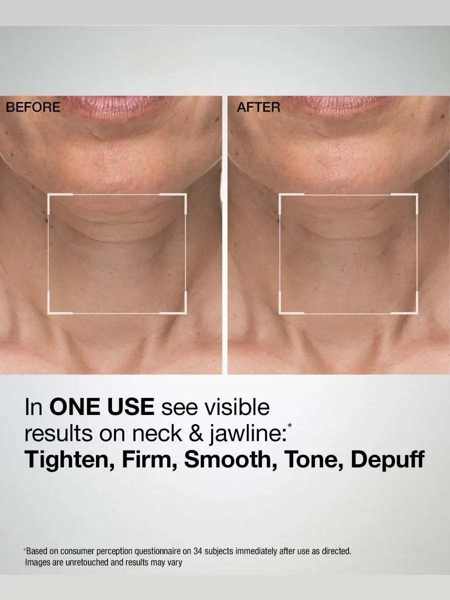 Маска для контура лица и шеи модели TL Advanced Sculpting Jawline and Neck Mask StriVectin — изображение 2 из 9