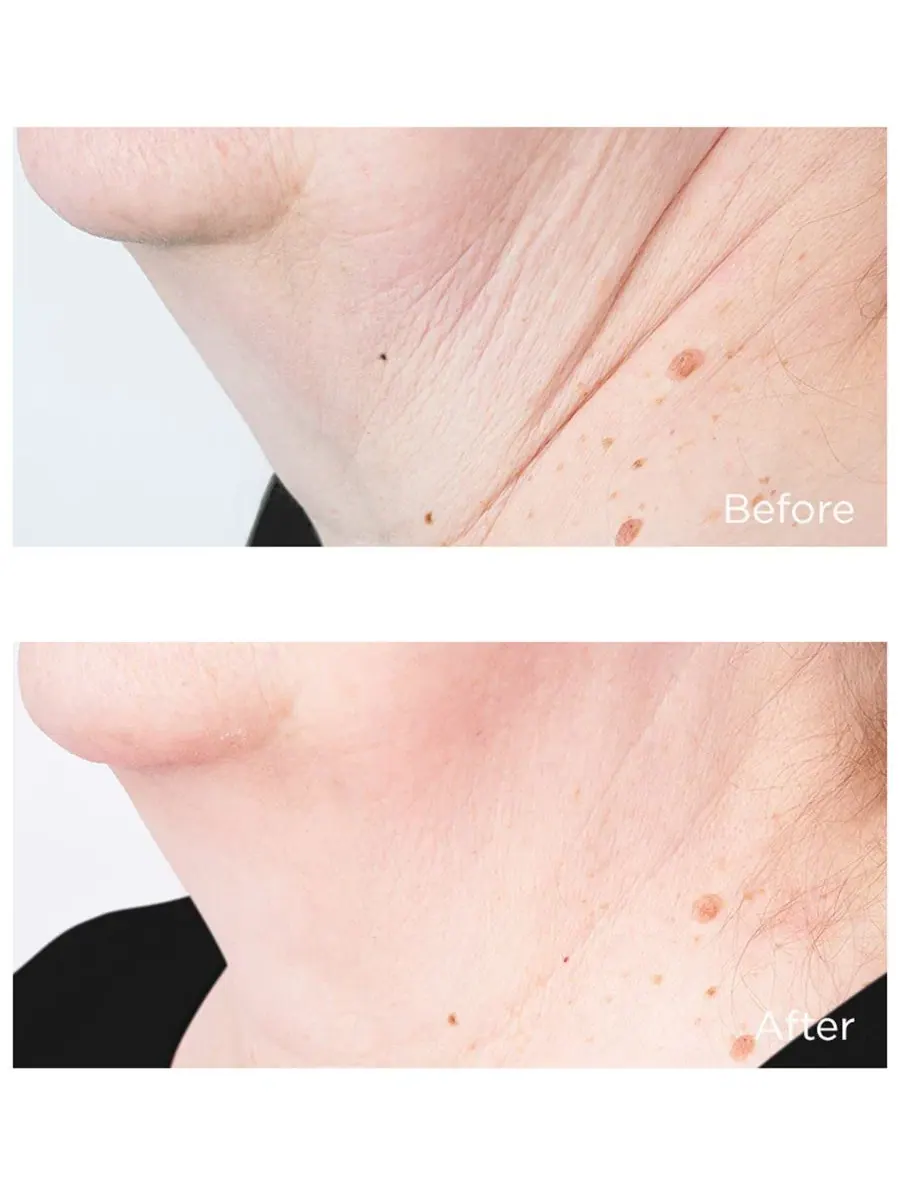 Крем для шеи и контура лица с лифтинг-эффектом, 118 мл, Cold Plasma Plus+ Sub-D/Neck Perricone MD — изображение 3 из 4