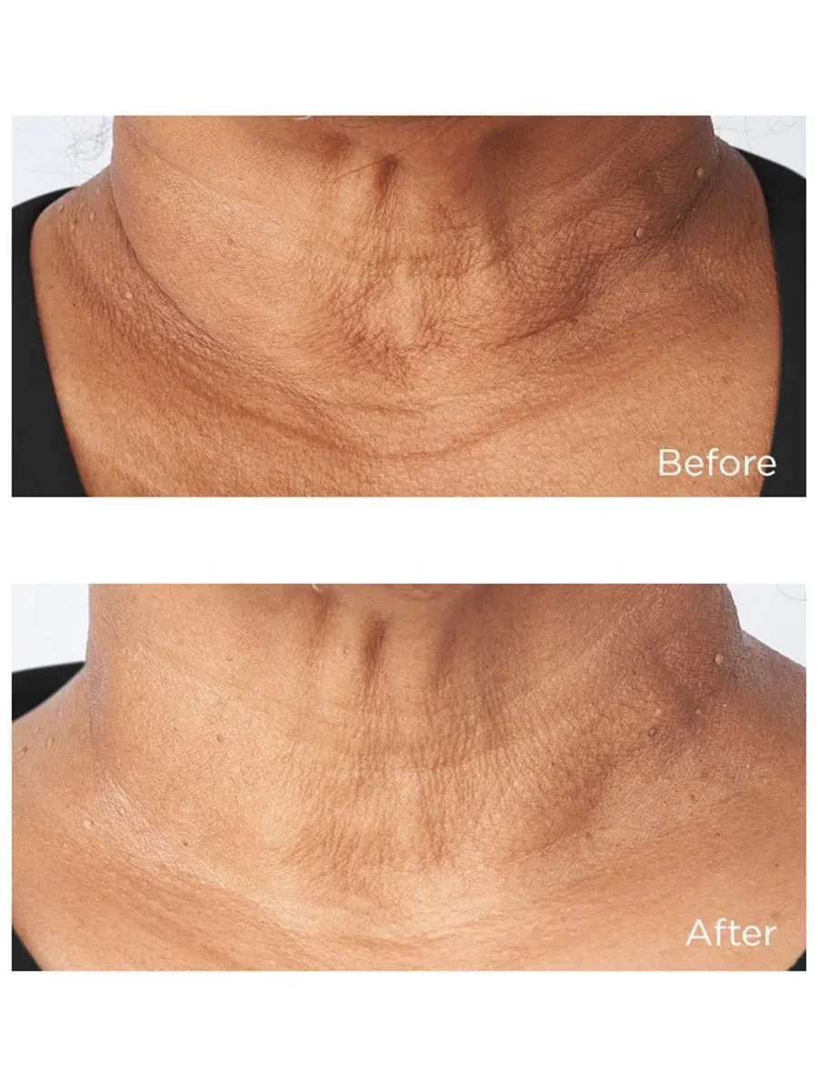 Крем для шеи и контура лица с лифтинг-эффектом, 118 мл, Cold Plasma Plus+ Sub-D/Neck Perricone MD — изображение 4 из 4