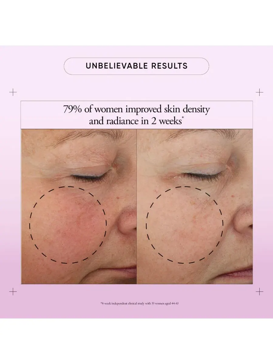 Крем для лица Ultimate Miracle Worker Broad Spectrum SPF 30, 60 мл philosophy — изображение 4 из 6