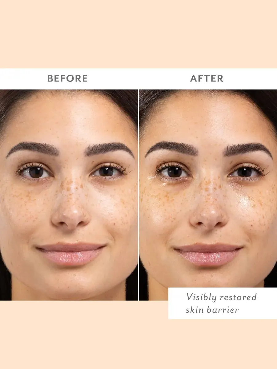 Сыворотка Patchology — Тканевые маски Skin Remedy для укрепления защитного барьера кожи — изображение 5 из 5