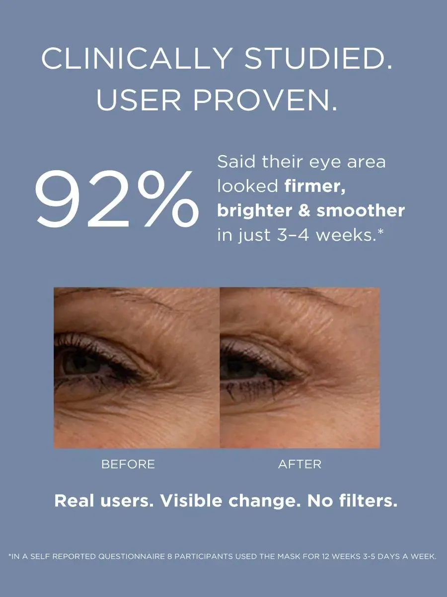 Прибор для ухода за кожей вокруг глаз Solaris Laboratories NY Eye Refresh Pro, с LED-терапией — изображение 2 из 8
