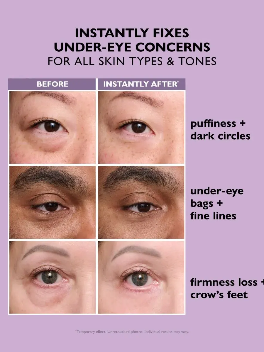 Peter Thomas Roth Временный крем для глаз Instant FIRMx Eye Temporary Eye Tightener, формула для — изображение 3 из 10