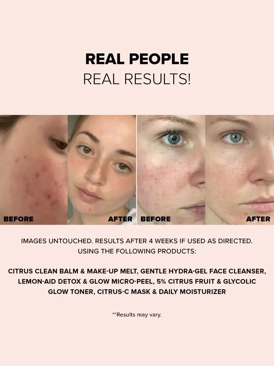 Гель для умывания Nudestix — Nudeskin Gentle Hydra-Gel Face Cleanser — изображение 3 из 10
