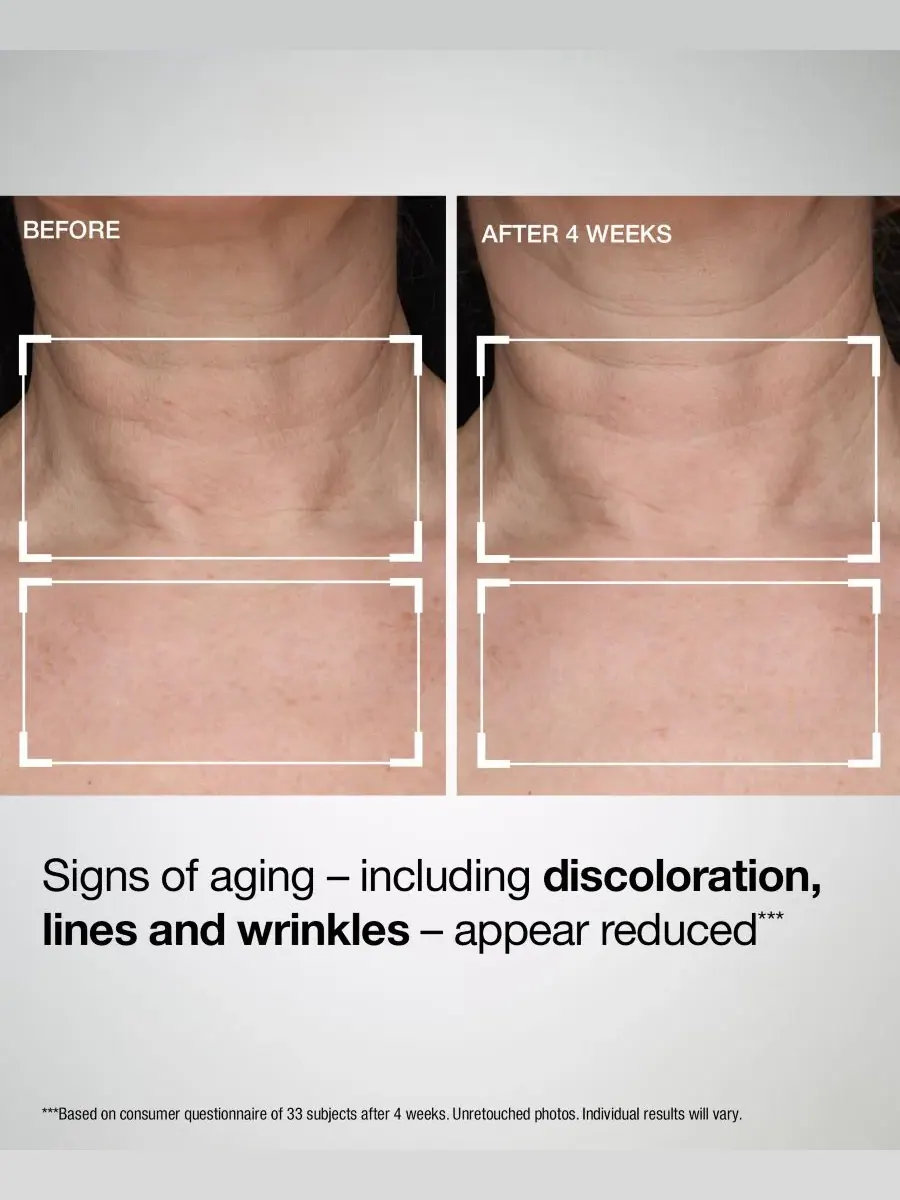 StriVectin TL Advanced Подтягивающий лосьон для шеи и груди с широким спектром защиты SPF 35, 44 г — изображение 5 из 7