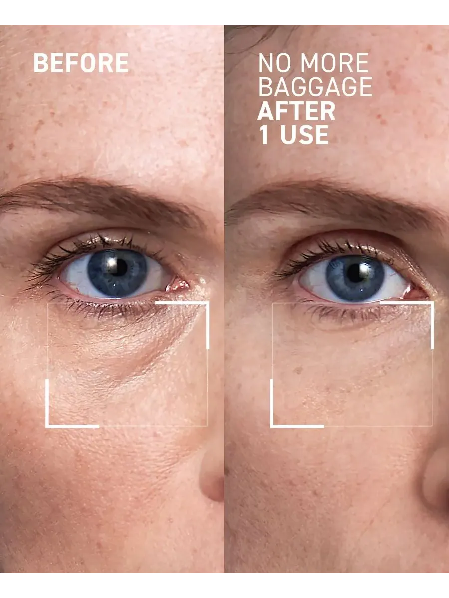 Крем для лица Dr. Brandt — Гель для снятия отечности под глазами No More Baggage Eye De-Puffing Gel, — изображение 2 из 8
