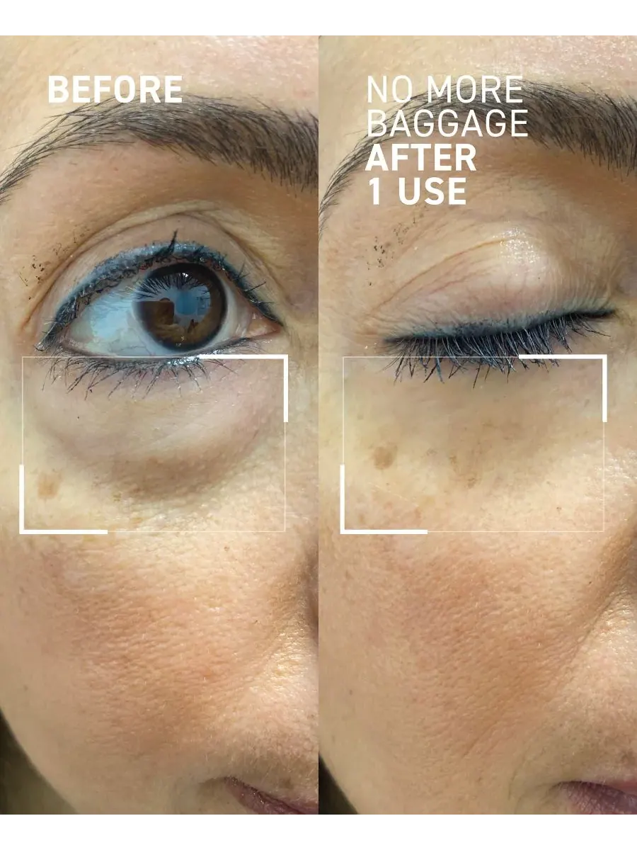 Крем для лица Dr. Brandt — Гель для снятия отечности под глазами No More Baggage Eye De-Puffing Gel, — изображение 3 из 8