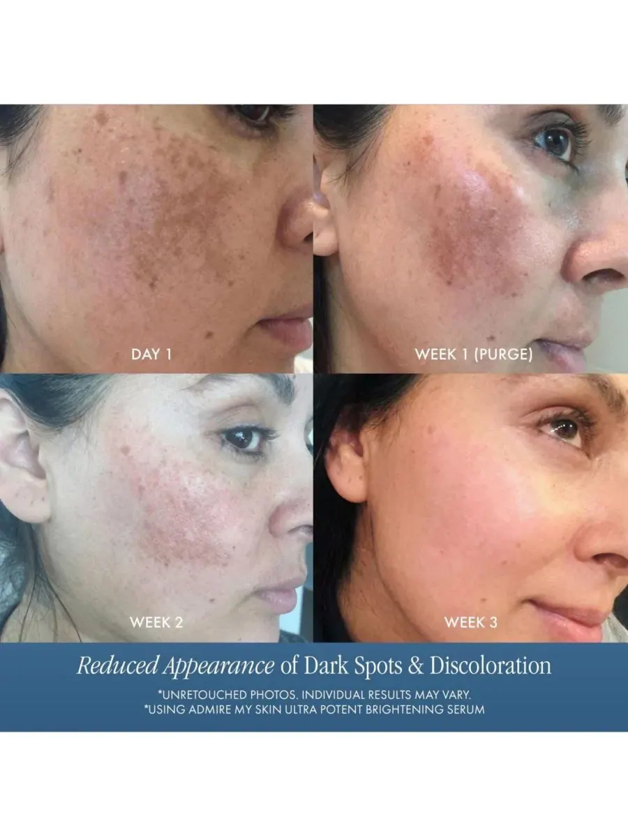 Сыворотка для лица с 1% Synovea HR, осветляющая, от темных пятен Admire My Skin — изображение 4 из 8