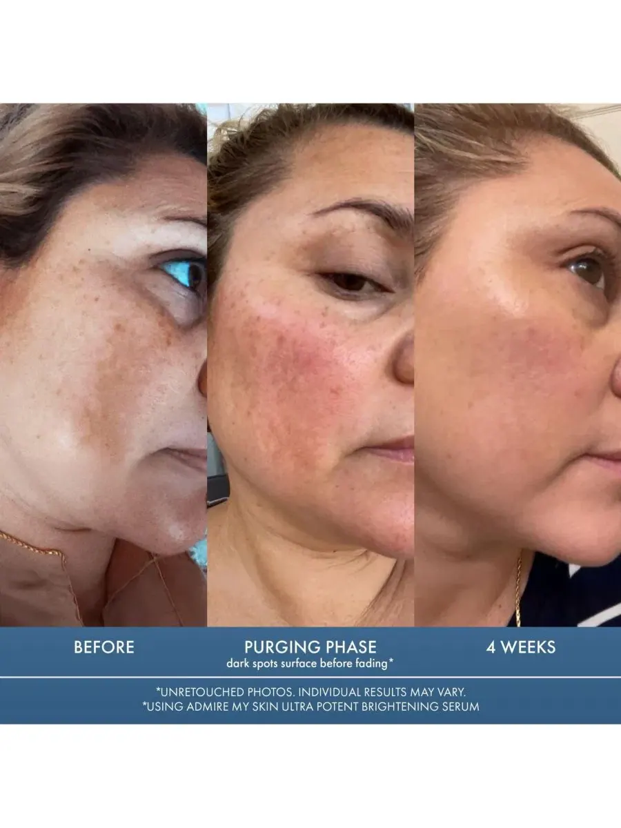 Сыворотка для лица с 1% Synovea HR, осветляющая, от темных пятен Admire My Skin — изображение 6 из 8