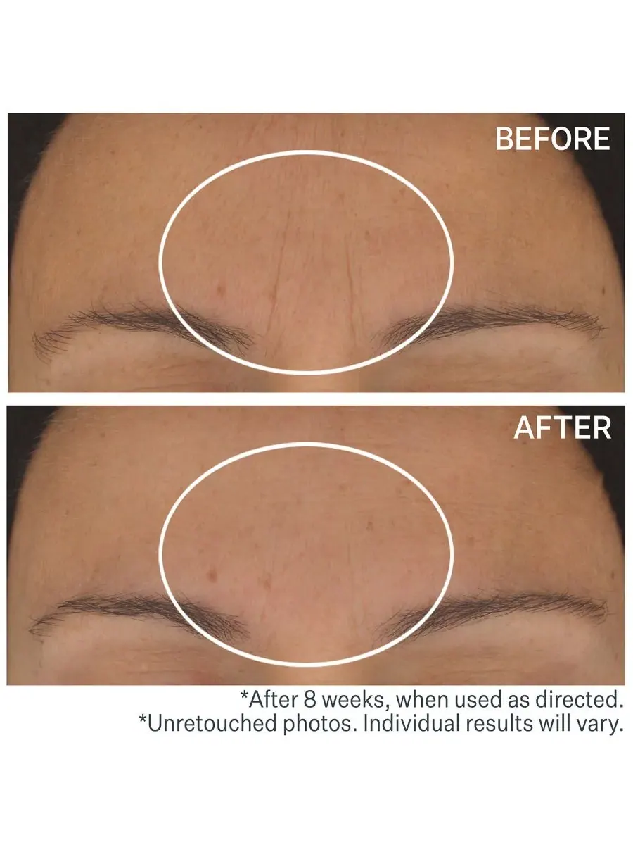 StriVectin STAR Light Retinol Night Oil, 1 унция — изображение 3 из 3