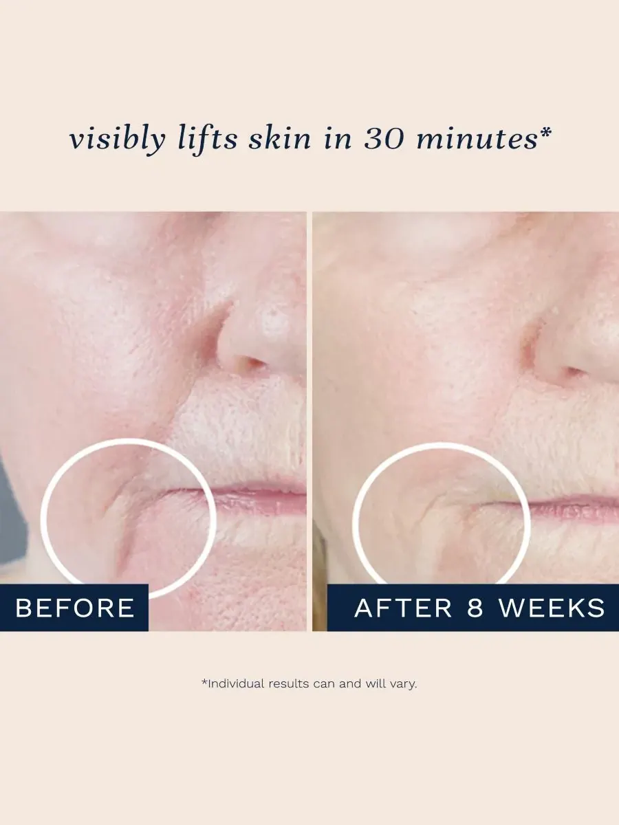 Тоник City Beauty — Укрепляющая Skin UpLift, 30 мл — изображение 3 из 10