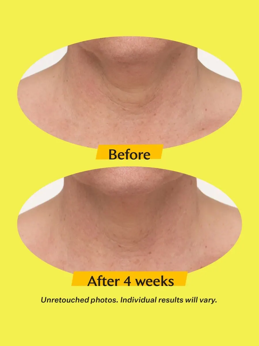 StriVectin Набор из 3 средств для подтяжки и лифтинга кожи — изображение 8 из 10