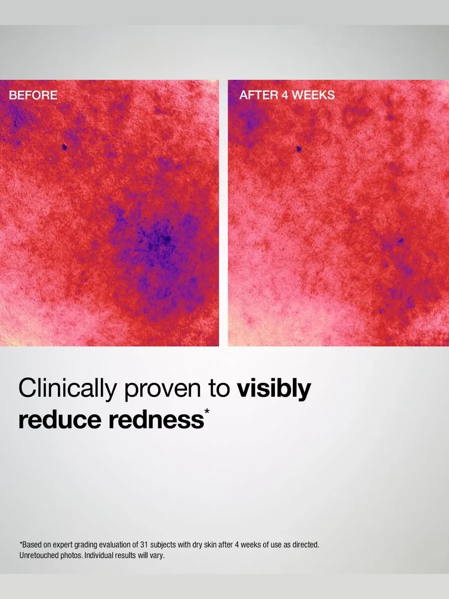 StriVectin Успокаивающий керамидный крем Barrier Restore+, 48 г — изображение 8 из 10