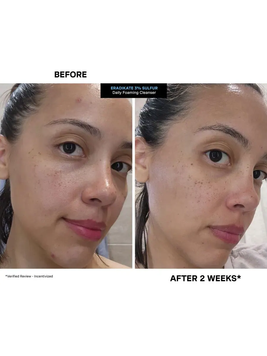 Гель для умывания Kate Somerville — Пенящееся очищающее средство EradiKate Daily Foaming Cleanser — изображение 7 из 8