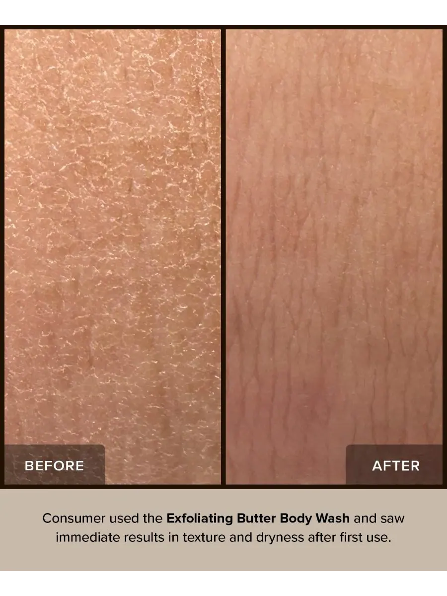 NUDESTIX Отшелушивающий гель для душа NUDEBODY, 240 мл — изображение 5 из 9