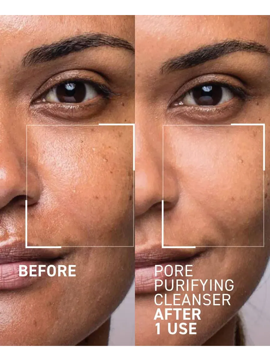 Гель для умывания Dr. Brandt — Очищающее средство для пор Pores No More, , None, 120 мл — изображение 2 из 6
