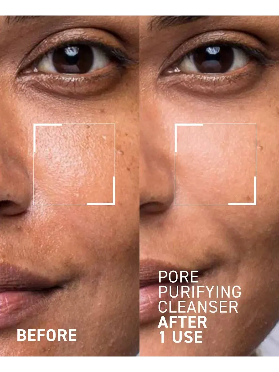 Гель для умывания Dr. Brandt — Очищающее средство для пор Pores No More, , None, 120 мл — изображение 3 из 6