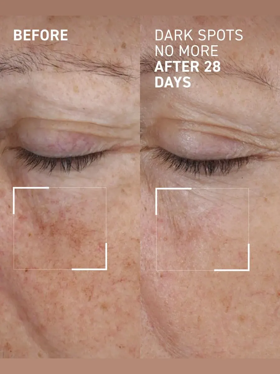 Сыворотка Dr. Brandt — Концентрат для уменьшения пигментных пятен Dark Spots No More Triple Acid — изображение 2 из 7