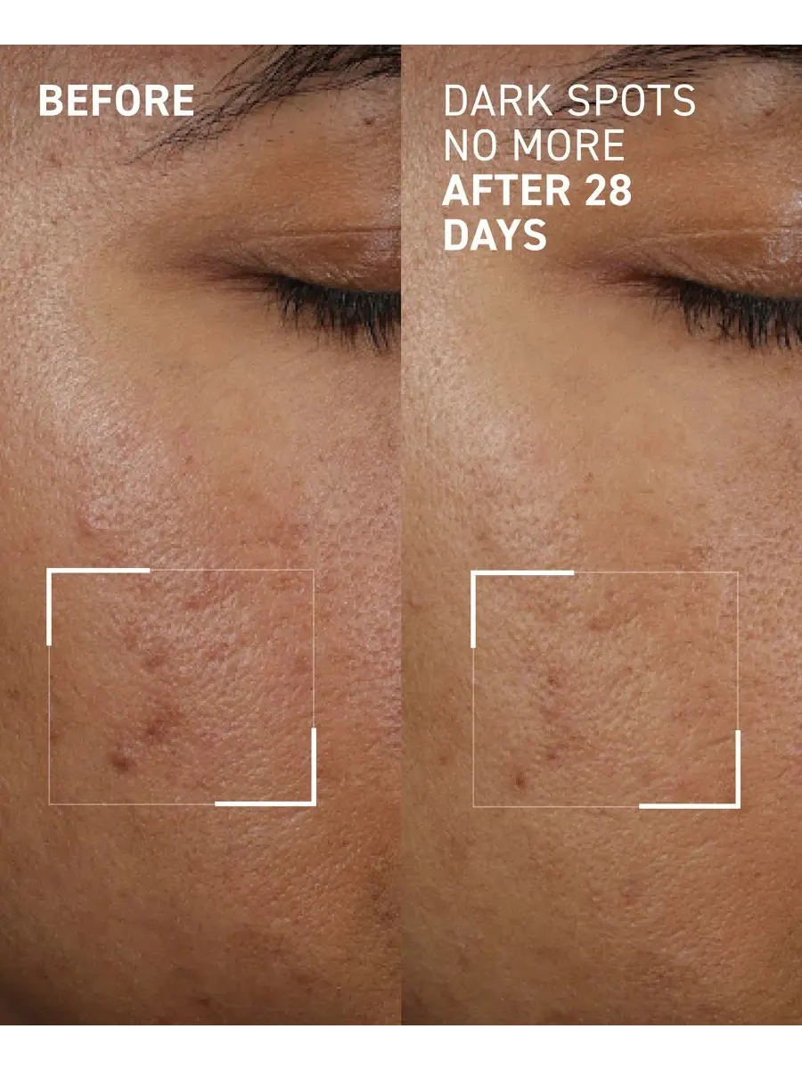 Сыворотка Dr. Brandt — Концентрат для уменьшения пигментных пятен Dark Spots No More Triple Acid — изображение 3 из 7