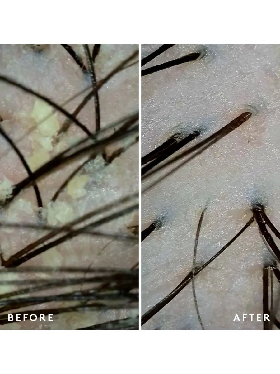 Кондиционер для кожи головы Scalp Remedy, 6, 7 унций Virtue — изображение 7 из 10