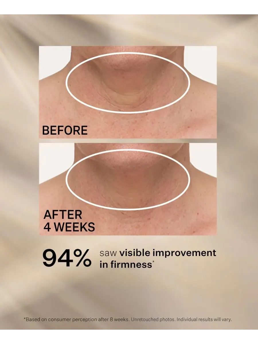 Сыворотка StriVectin — TL Advanced Tightening Neck Cream Plus With Alpha-3 Peptide — изображение 6 из 10
