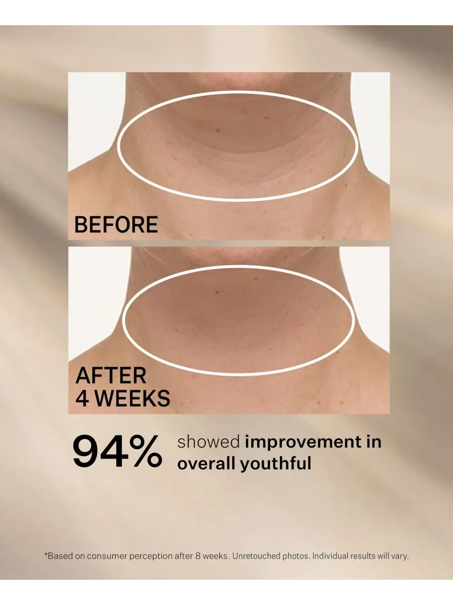 Сыворотка StriVectin — TL Advanced Tightening Neck Cream Plus With Alpha-3 Peptide — изображение 7 из 10