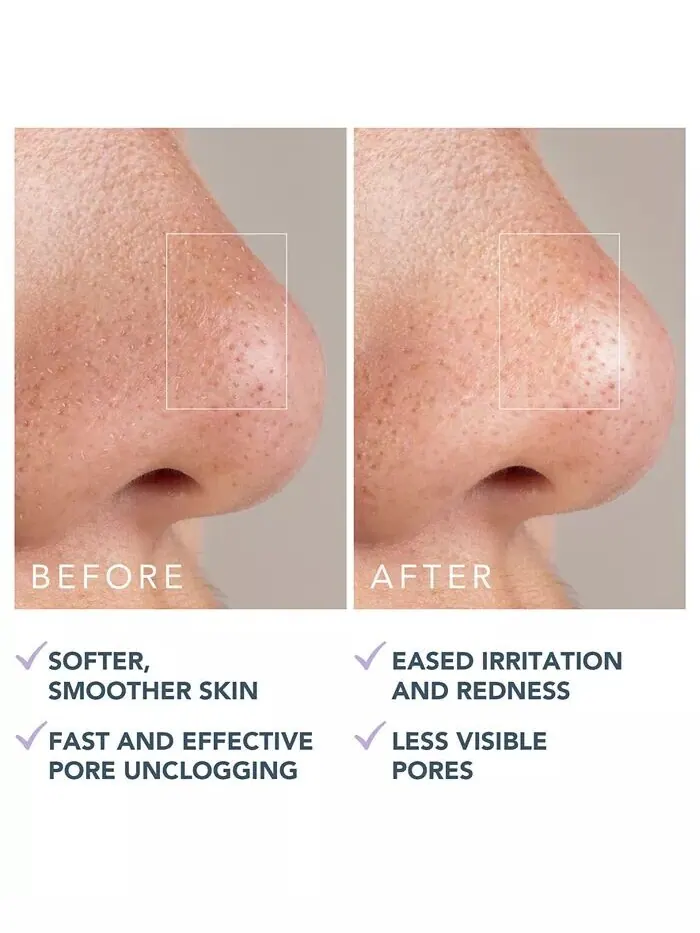 Маска для лица Foreo — От черных точек Kiwi Active Pore, 100 г — изображение 4 из 6