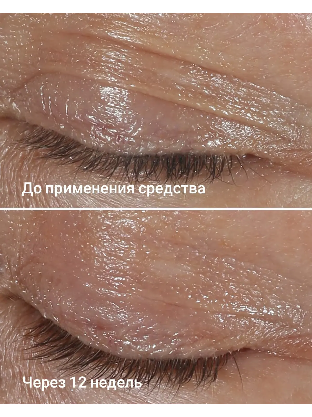 Крем Clinique Smart Clinical Repair Wrinkle Correcting, антивозрастной крем для кожи вокруг глаз — изображение 3 из 3