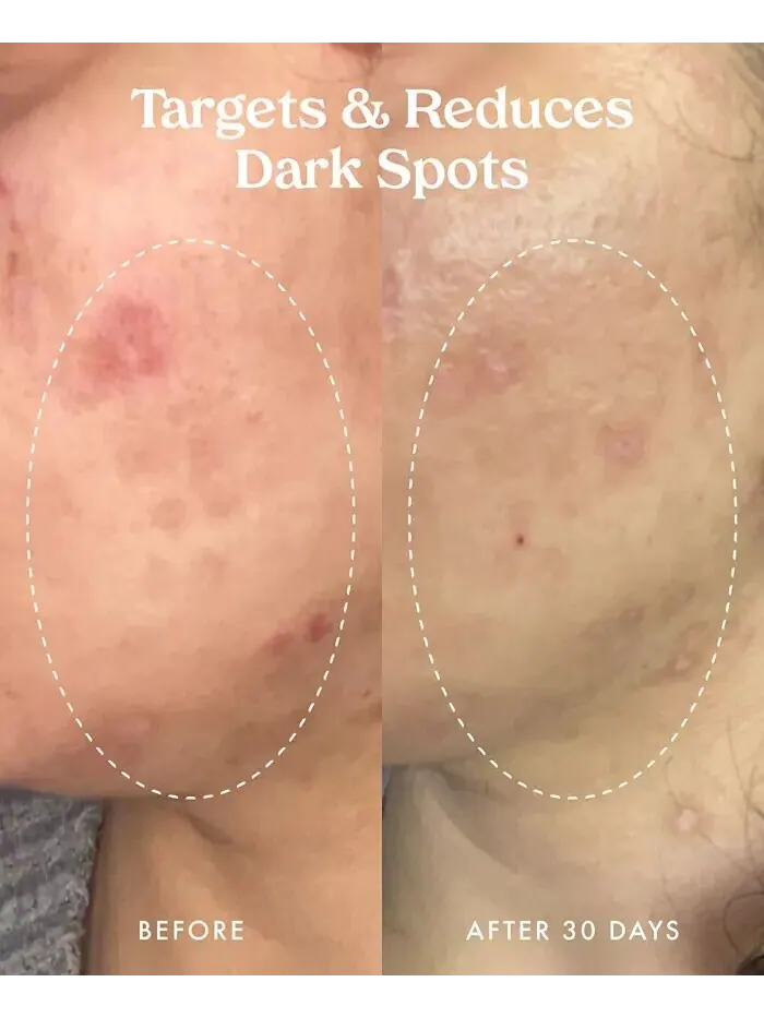 Сыворотка Kopari Beauty — Star Bright Корректирующая с витамином С — изображение 8 из 12