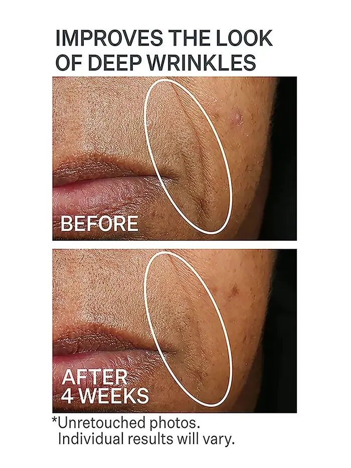 Крем для лица StriVectin — Увлажняющий барьерный Wrinkle Recode — изображение 5 из 8