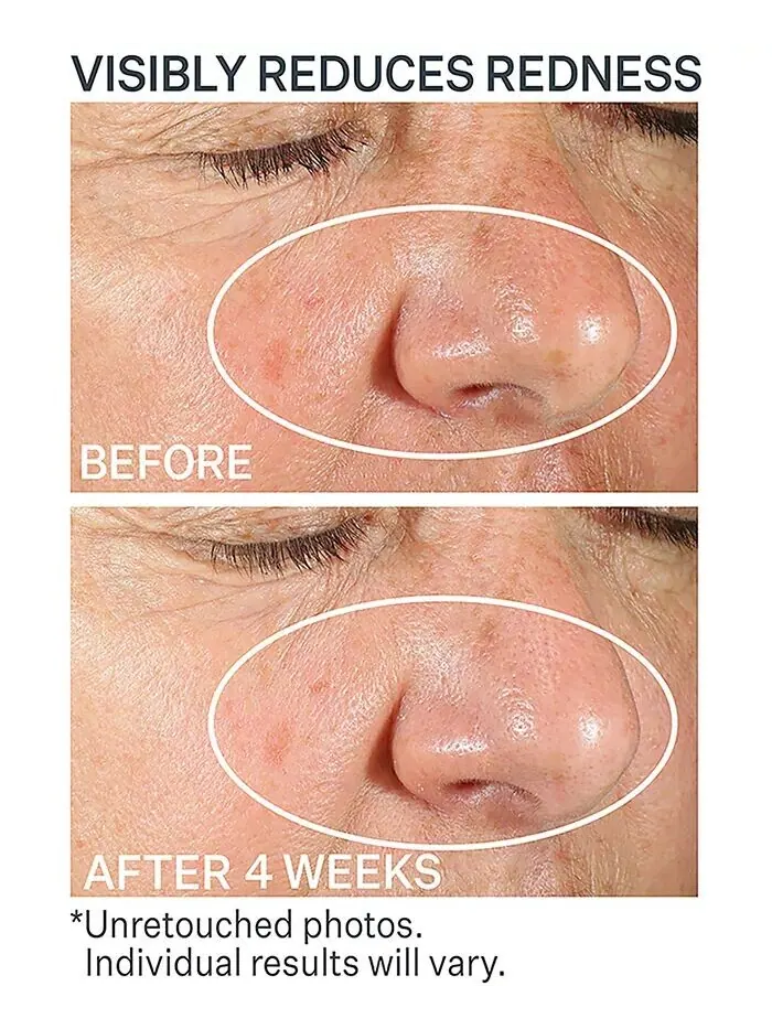 Крем для лица StriVectin — Увлажняющий барьерный Wrinkle Recode — изображение 6 из 8