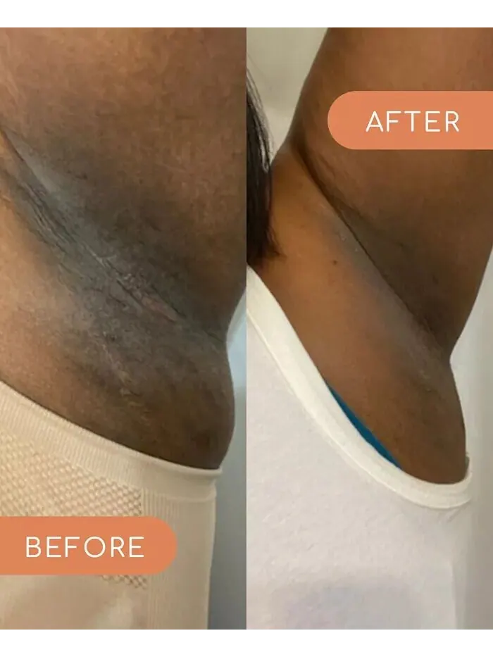 Оригинальный осветляющий крем-дезодорант для подмышек Forgotten Skincare — изображение 6 из 6
